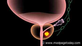 When Is ADT Right for Biochemically Recurrent Prostate Cancer?