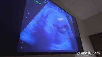 CDC urges all pregnant women to get vaccinated against COVID-19