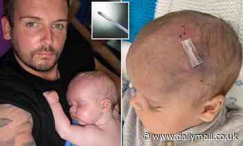 Baby boy is left with brain damage 'after NHS doctors stuck an electrode clip on his head'