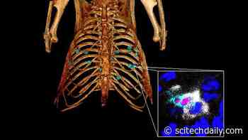 Lung Cancer: Breakthrough Offers Hope for Increasing Immunotherapy Efficacy