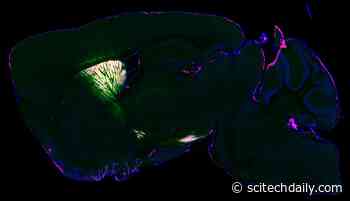 New Technique Identifies Proteins in the Living Brain – Offers Insight Into Brain Diseases and Treatments