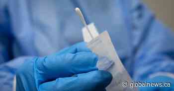 Alberta’s COVID-19 positivity, hospitalization and ICU rates tick up