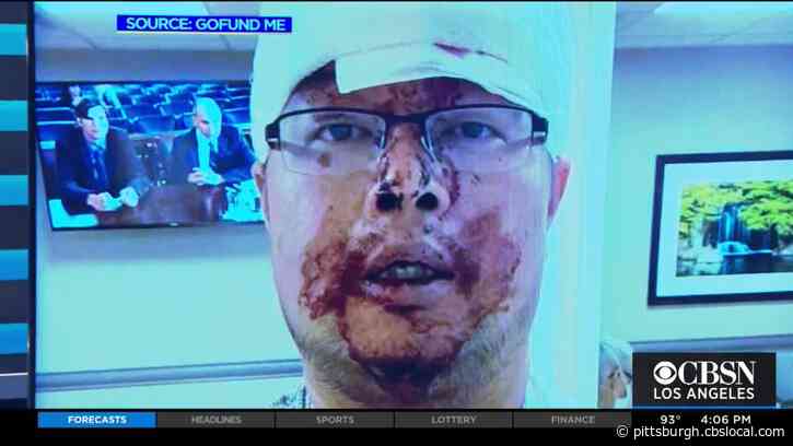 ‘I Think I Will Die’: Lyft Driver Brutally Beaten By Passenger Wants Policy Changes