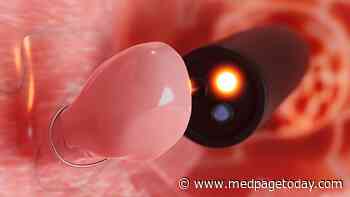 Incomplete Polyp Resection Proves Tricky Business for Cancer Risk