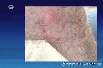 Bezoekers blotevoetenpad opgegeten door muggen: “Het zijn er veel en ze zijn agressief!”