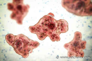 7-year-old boy dies from brain-eating amoeba in California, family says
