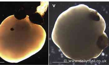 Tiny blobs of human brain cells are grown in a lab with rudimentary 'eyes' that can detect light 