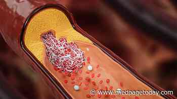 Statin Users See Good Changes in Atherosclerotic Plaques