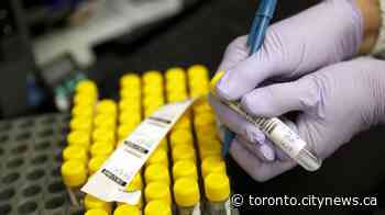 Over 500 new cases of COVID-19 reported in Ontario - CityNews Toronto