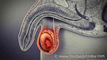 Study Confirms, Clarifies Excess Mortality in Testicular Cancer Survivors