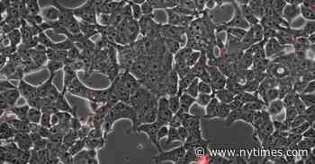 A microscopic video shows the coronavirus on the rampage. - The New York Times