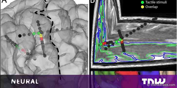 Eureka! Brain implant creates feelings in the fingertips