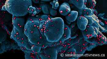 Saskatoon wastewater monitoring project sees highest ever coronavirus levels