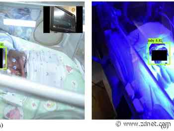 UniSA researchers develop AI facial recognition tech to monitor premature babies