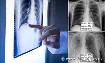 AI can guess a person's race with up to 99% accuracy just by looking at their X-rays