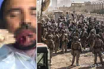 Antwerpse winkelier neergeschoten aan luchthaven Kaboel: “Hij kan niet eten en niet praten” - Gazet van Antwerpen