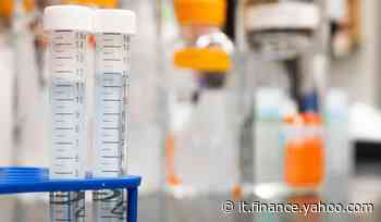 Sette giovani positivi a seguito dello scoppio di un focolaio ad Ardea (Roma) - Yahoo Finanza