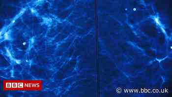 Breast cancer: The AI tool trained to spot the disease