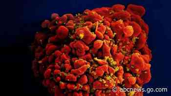 Johnson & Johnson HIV vaccine trial fails mid-stage study