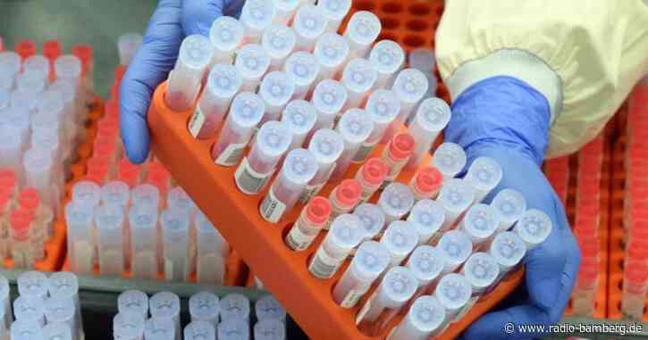 WHO listet neue Corona-Variante «von Interesse»