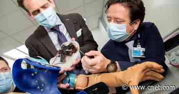 Futuristic bionic arm uses mini robots to return natural reflexes to amputees     - CNET