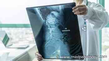 No Sex Difference Seen for Ankylosing Spondylitis