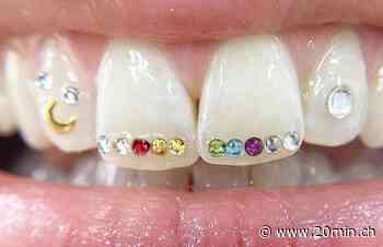 Zahnarzt verrät: Wie schädlich sind Zahnkristalle für die Zähne? - 20 Minuten