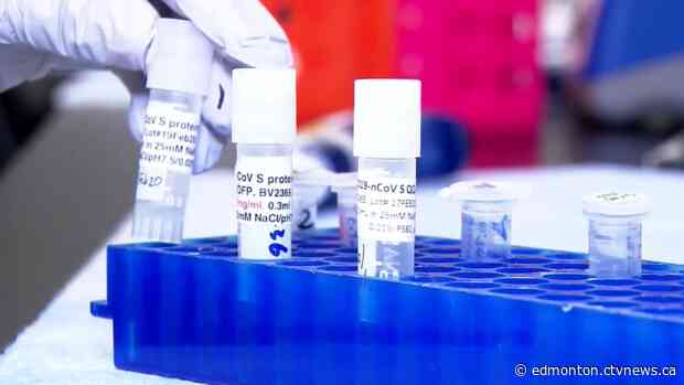 Alberta to keep COVID-19 testing past Sept. 27
