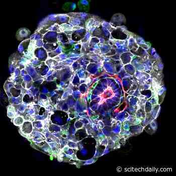 Trigger Identified for “Head-to-Tail” Axis Development in Human Embryo
