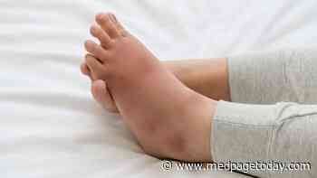 Warning: Patient's Itchy Swollen Skin Patches Were Not Infectious Cellulitis
