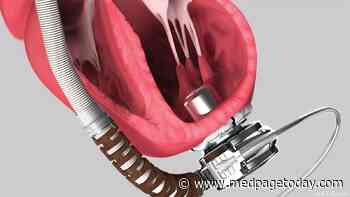 Some Reassurance on Cognition in People With Older LVADs