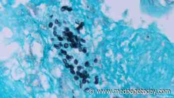 Pneumocystis Often Lethal in Dermatomyositis