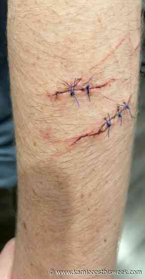 Attack on teen has Kamloops mom issuing a warning - Kamloops This Week