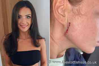 Illegal ‘Barbie’ nasal spray and sunbeds leave Barrhead tanning fan with facial scar in cancer scare... - The Scottish Sun