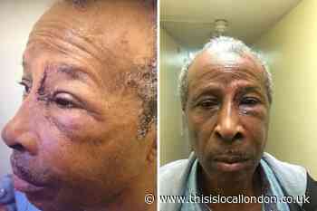 Black man, 70, suffers facial injuries in Bromley arrest