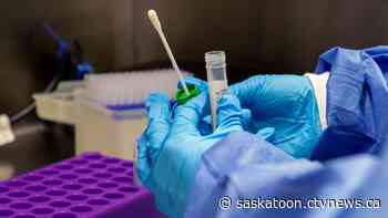 City of Saskatoon launching mandatory COVID-19 testing program for staff