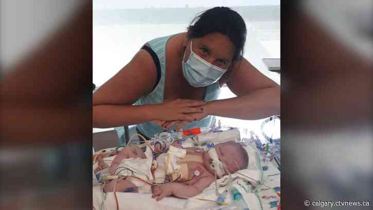 Alberta Children’s Hospital to shut down 75 per cent of operating rooms