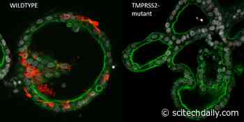 When Organoids Meet Coronaviruses: Assessing Potential COVID Drug Targets