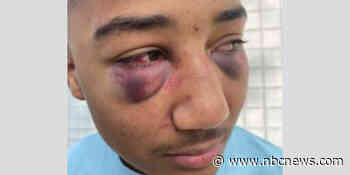 Former California officers indicted for allegedly beating Black teen
