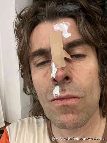 Liam Gallagher falls from helicopter after Isle of Wight Festival