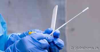 COVID-19: Saskatchewan breaks daily case, hospitalization records