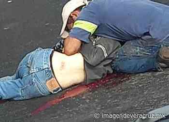 Muere menor arrollado en la carretera Coatepec-Tuzamapan - Imagen de Veracruz