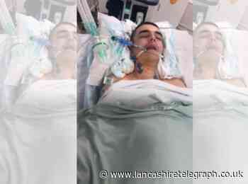 Blackburn teen left needing heart surgery after being stabbed in chest