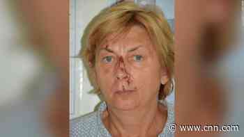Woman found injured on Croatian island doesn't know her name or how she got there