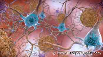 Amyloid Tipping Point Helps Predict Alzheimer's Dementia Onset