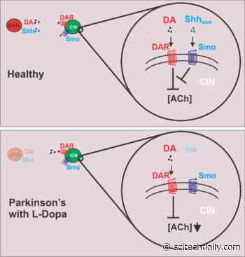 Sonic Hedgehog Protein Pathway Stimulation Could Help Treat Parkinson’s Disease
