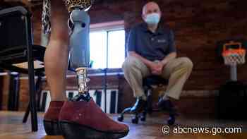 Woman plans to help fellow Rwandan amputees get prosthetics