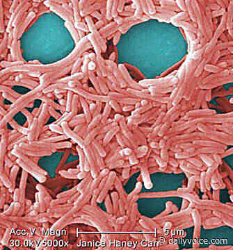 More Cases, Another Death Reported In NJ Legionnaires' Outbreak - Northern Highlands Daily Voice