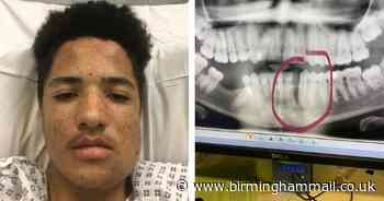 Thugs break teen’s jaw in brutal McDonald’s attack in Sutton Coldfield - Birmingham Live