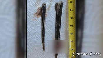 Rhode Island man recovers after being stung by 300 pound stingray - WJAR